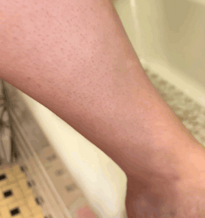 Nostalgic crystal hair remover