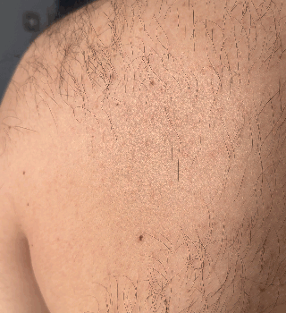 Nostalgic crystal hair remover